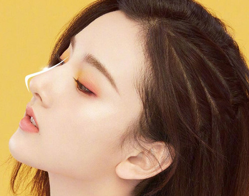 nâng mũi cao quá