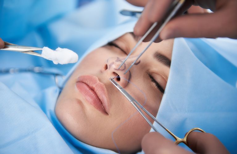 nâng mũi bác sĩ nào tại tphcm